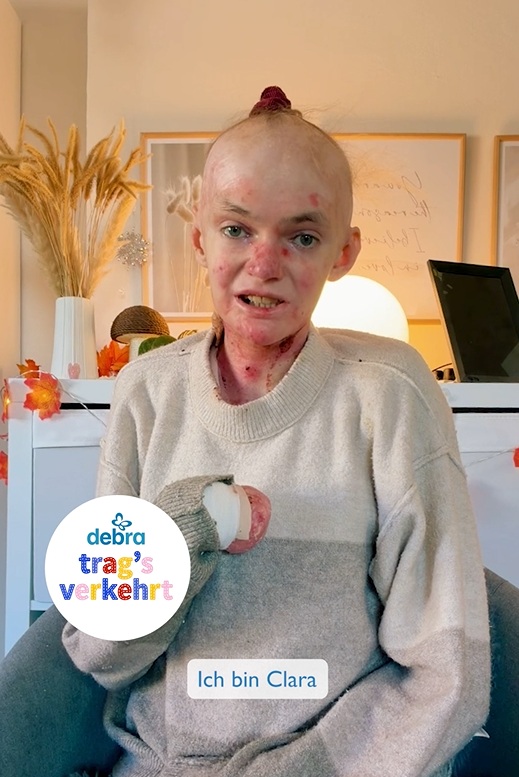 Schmetterlingskind trägt Pulli verkehrt